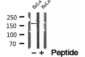 Western blot analysis of extracts of HeLa cells, using PTPN23 antibody. (PTPN23 抗体  (C-Term))