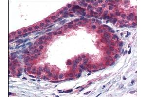 Immunohistochemistry Image: Human Prostate: Formalin-Fixed, Paraffin-Embedded (FFPE) (PPARD 抗体  (C-Term))