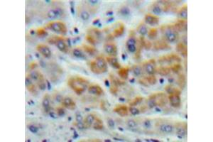 Used in DAB staining on fromalin fixed paraffin-embedded Liver tissue (Cystathionine (AA 14-224) 抗体)