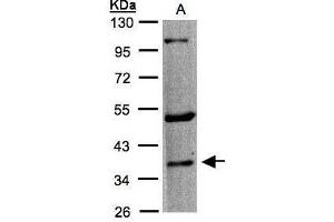 WB Image Sample(30 μg of whole cell lysate) A:A431, 10% SDS PAGE antibody diluted at 1:1000 (HTR1F 抗体  (C-Term))