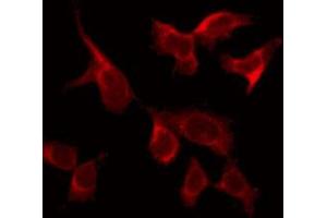 Immunofluorescence (fixed cells) (IF/ICC) image for anti-Colony Stimulating Factor 1 Receptor (CSF1R) (C-Term) antibody (ABIN6263042)