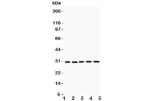 Western blot testing of CD82 antibody and Lane 1:  HL-60;  2: CEM;  3: HUT;  4: U937;  5: MCF-7 (CD82 抗体  (AA 98-267))