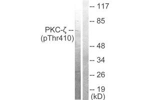 Western Blotting (WB) image for anti-Protein Kinase C, zeta (PRKCZ) (pThr410) antibody (ABIN6298749) (PKC zeta 抗体  (pThr410))