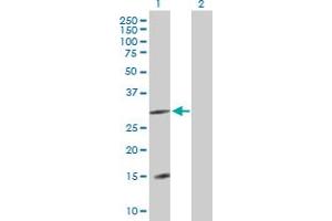 Western Blot analysis of DNAJC22 expression in transfected 293T cell line by DNAJC22 MaxPab polyclonal antibody. (DNAJC22 抗体  (AA 1-341))