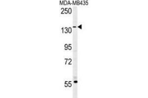 Western blot analysis in MDA-MB435 cell line lysates (35ug/lane) using CD227 / Mucin-1 / MUC1 Antibody . (MUC1 抗体  (AA 1209-1239))