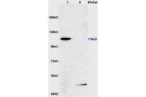 Lane 1: mouse testis lysates Lane 2: mouse pancreas lysates probed with Anti phospho-FAK(Ser722) Polyclonal Antibody, Unconjugated (ABIN711056) at 1:200 in 4 °C. (FAK 抗体  (pSer722))