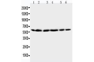 Anti-HSP60 antibody, Western blotting Lane 1: Rat Brain Tissue Lysate Lane 2: Rat Liver Tissue Lysate Lane 3: CEM Cell Lysate Lane 4: HELA Cell Lysate Lane 5: SMMC Cell Lysate Lane 6: COLO320 Cell Lysate (HSPD1 抗体  (C-Term))