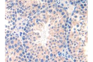 DAB staining on IHC-P; Samples: Mouse Testis Tissue (nectin-3 抗体  (AA 90-293))