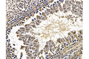 ABIN7095037 and ABIN7099093 at 1/100 staining rat testis tissue by IHC-P. (CCDC39 抗体)