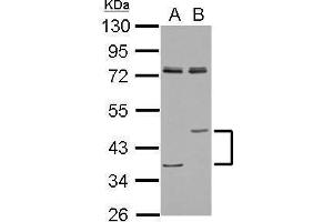 WB Image Sample (30 ug of whole cell lysate) A: A549 B: H1299 10% SDS PAGE antibody diluted at 1:1000 (Lipase A 抗体  (Center))