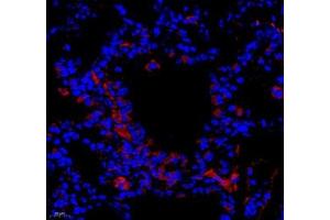 Immunofluorescence of paraffin embedded mouse lung using LRP (ABIN7074548) at dilution of 1: 250 (400x lens) (MVP 抗体)