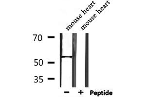 Western blot analysis of extracts from mouse heart, using TRMT11 Antibody. (Trmt11 抗体  (C-Term))
