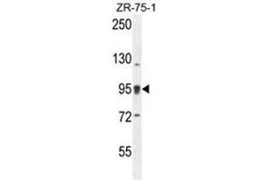 Western Blotting (WB) image for anti-ArfGAP with Coiled-Coil, Ankyrin Repeat and PH Domains 1 (ACAP1) (AA 103-132), (N-Term) antibody (ABIN950226)