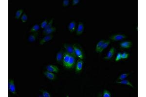 Immunofluorescent analysis of HepG2 cells using ABIN7173175 at dilution of 1:100 and Alexa Fluor 488-congugated AffiniPure Goat Anti-Rabbit IgG(H+L) (FAM70A 抗体  (AA 110-225))
