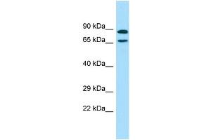 WB Suggested Anti-POF1B Antibody Titration: 1. (POF1B 抗体  (C-Term))