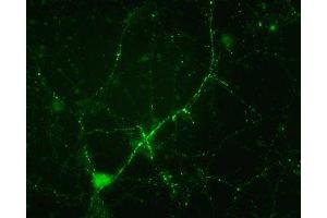 Immunostaining of cultured mouse caudate neurons showing synapsin I when phosphorylated at Ser549. (SYN1 抗体  (pSer549))
