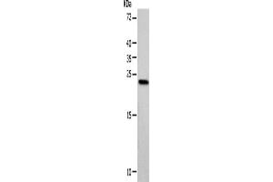 Western blot analysis of Hela cells using VSNL1 Polyclonal Antibody at dilution of 1:900 (VSNL1 抗体)