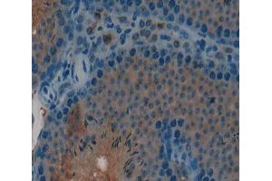 Used in DAB staining on fromalin fixed paraffin- embedded Kidney tissue (CGB 抗体  (AA 55-153))