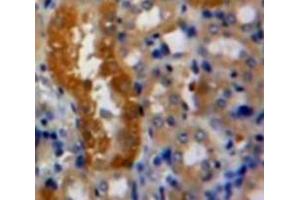 Used in DAB staining on fromalin fixed paraffin-embedded Kidney tissue (RNH1 抗体  (AA 76-333))