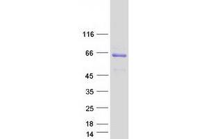 Western Blotting (WB) image for Cartilage Associated Protein (CRTAP) protein (Myc-DYKDDDDK Tag) (ABIN2712569)