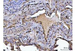 IHC analysis of PTRF/CAVIN1 using anti-PTRF/CAVIN1 antibody (ABIN7601817). (PTRF 抗体  (AA 47-390))