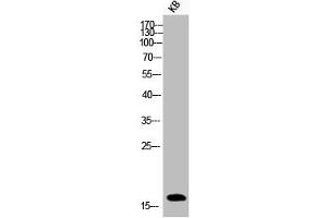 Western Blot analysis of KB cells using Phospho-Histone H3 (S10) Polyclonal Antibody (HIST1H3A/HIST2H3A/H3F3A (pSer10) 抗体)
