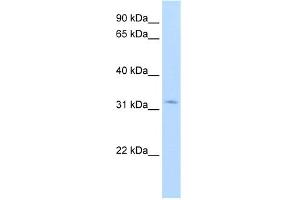 WB Suggested Anti-HSD17B6 Antibody Titration:  1. (HSD17B6 抗体  (N-Term))