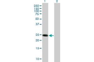 Western Blot analysis of HRAS expression in transfected 293T cell line by HRAS MaxPab polyclonal antibody. (HRAS 抗体  (AA 1-189))