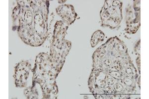 Immunostaining (ISt) image for anti-Myoneurin (MYNN) (AA 501-610) antibody (ABIN565953)