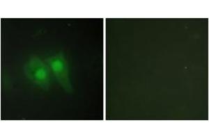 Immunofluorescence analysis of HeLa cells, using STEA3 Antibody. (STEAP3 抗体  (AA 421-470))