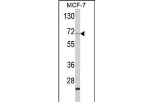 Western blot analysis of ZYG11A Antibody (N-term) (ABIN652620 and ABIN2842414) in MCF-7 cell line lysates (35 μg/lane). (ZYG11A 抗体  (N-Term))