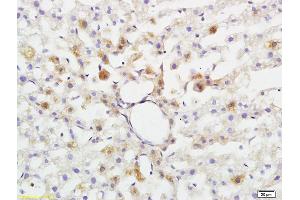 Formalin-fixed and paraffin embedded rat brain tissue labeled with Anti-ABHD5 Polyclonal Antibody, Unconjugated (ABIN708596) at 1:200 followed by conjugation to the secondary antibody and DAB staining (ABHD5 抗体  (AA 281-349))
