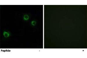 Immunofluorescence analysis of HUVEC cells, using CLDN6 polyclonal antibody . (Claudin 6 抗体)