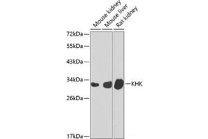 Western blot analysis of extracts of various cell lines using KHK Polyclonal Antibody at dilution of 1:1000. (Ketohexokinase 抗体)