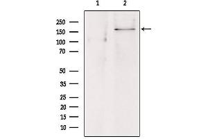 Western blot analysis of extracts from hepg2, using ABCC8 Antibody. (ABCC8 抗体)
