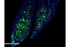 Immunohistochemistry analysis using Mouse Anti-Thyroid Hormone Receptor Monoclonal Antibody, Clone H43 (ABIN6952062). (THRA 抗体  (PerCP))