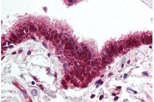 Human Lung, Respiratory Epithelium (formalin-fixed, paraffin-embedded) stained with SKIL antibody ABIN295508 at 5 ug/ml followed by biotinylated goat anti-rabbit IgG secondary antibody ABIN481713, alkaline phosphatase-streptavidin and chromogen. (SKIL 抗体  (AA 600-684))