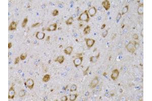 Immunohistochemistry of paraffin-embedded rat brain using NGF antibody (ABIN6293296) at dilution of 1:75 (40x lens). (Nerve Growth Factor 抗体)