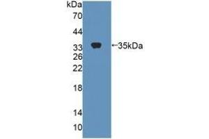 Western Blotting (WB) image for anti-Carboxylesterase 1 (CES1) (AA 19-300) antibody (ABIN7434857)