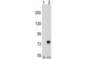 Western blot analysis of TGFBI antibody and 293 cell lysate either nontransfected (Lane 1) or transiently transfected (2) with the TGFBI gene. (TGFBI 抗体  (AA 106-135))