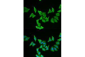Immunofluorescence analysis of U2OS cells using MLN antibody (ABIN5973790). (Motilin 抗体)