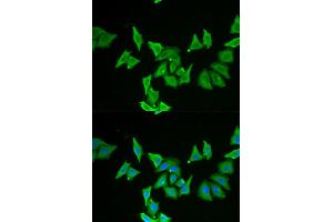 Immunofluorescence analysis of U2OS cells using MLN antibody (ABIN5973790). (Motilin 抗体)