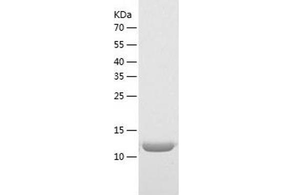 CD164 Protein (CD164) (AA 24-162) (His tag)