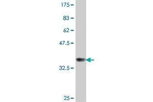 Western Blot detection against Immunogen (37. (UBR2 抗体  (AA 1-100))