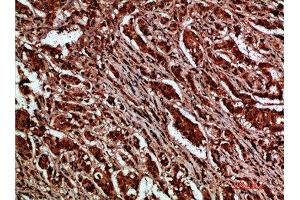 Immunohistochemistry (IHC) image for anti-Catenin (Cadherin-Associated Protein), delta 1 (CTNND1) (AA 841-890) antibody (ABIN7189533)