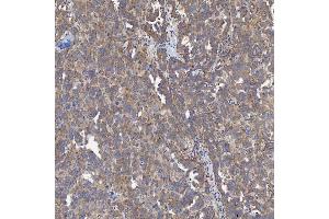 IHC analysis of ACAD9 using anti-ACAD9 antibody (ABIN7602670).