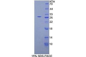 SDS-PAGE (SDS) image for phospholipase C, gamma 1 (PLCG1) (AA 1091-1290) protein (His tag) (ABIN1878587)