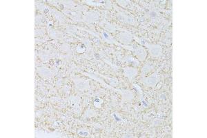 Immunohistochemistry of paraffin-embedded rat brain using PHGDH antibody.