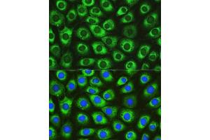 Immunofluorescence analysis of L929 cells using DN Rabbit pAb (ABIN6130306, ABIN6139717, ABIN6139719 and ABIN6215728) at dilution of 1:100. (DNAJC10 抗体  (AA 614-793))