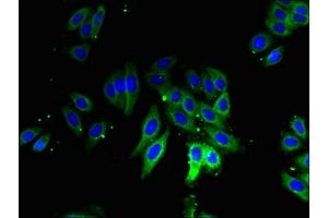 Immunofluorescent analysis of HepG2 cells using ABIN7142723 at dilution of 1:100 and Alexa Fluor 488-congugated AffiniPure Goat Anti-Rabbit IgG(H+L) (RPLP1 抗体  (AA 2-114))